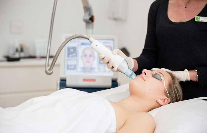 Mosaic Fractional Laser